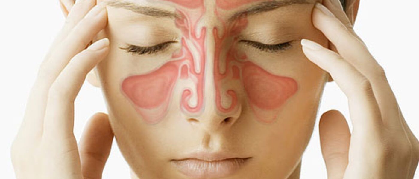 Cómo curar la sinusitis