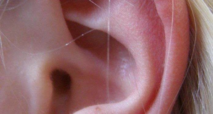 Otoplastia: cirugía de corrección de orejas