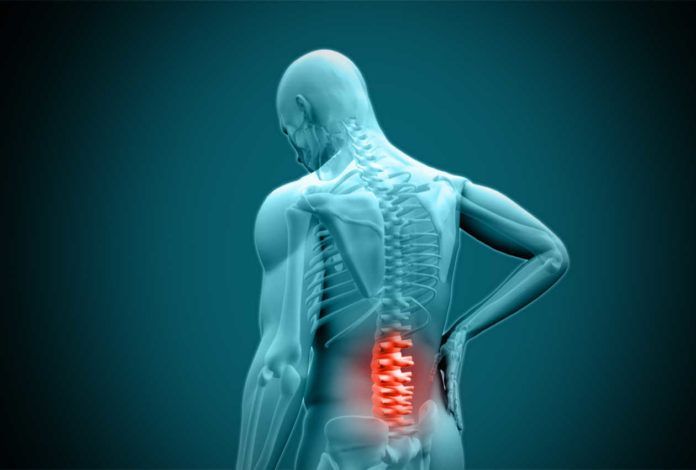Ciatalgia o dolor en la parte baja de la espalda